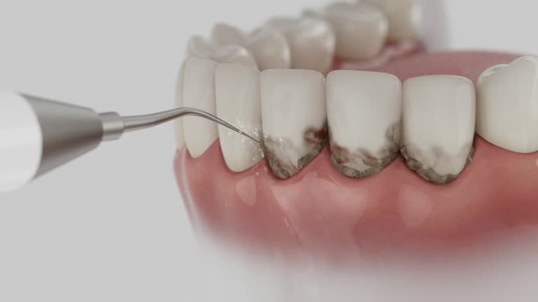Reliable Dental Implants contractor in Snyder, OK by Smile Center Dentistry